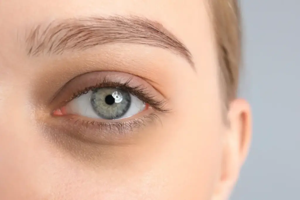 Dark Circle Treatment in London, ON: PRF & Under-Eye Fillers