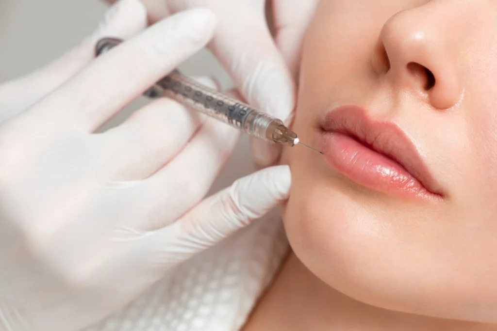 A woman getting HA filler injection in London, ON