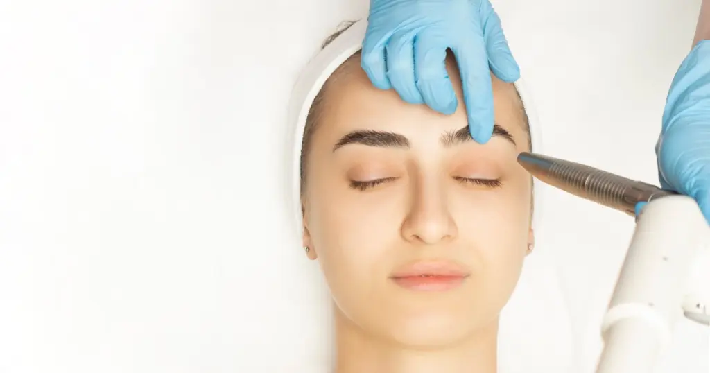 Women receiving a Fotona4D Treatment on their forehead in London, ON
